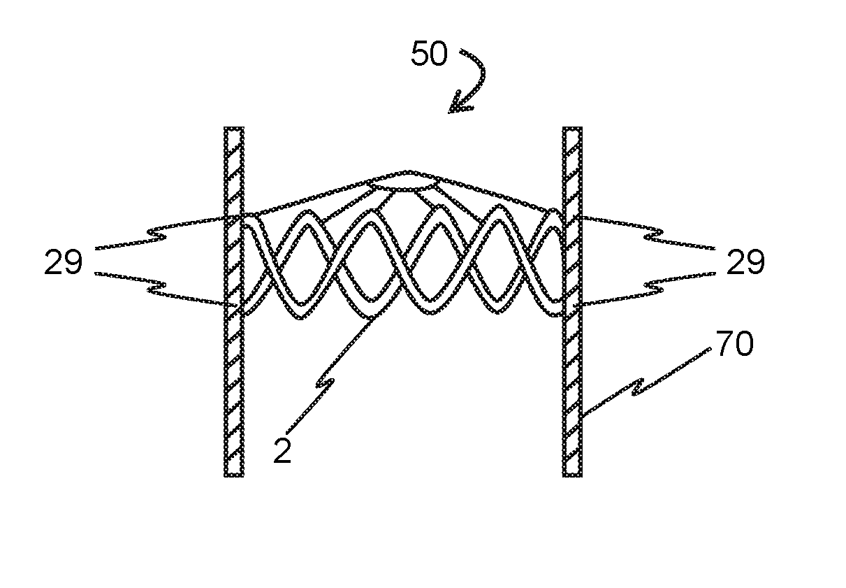 Absorbable vascular filter