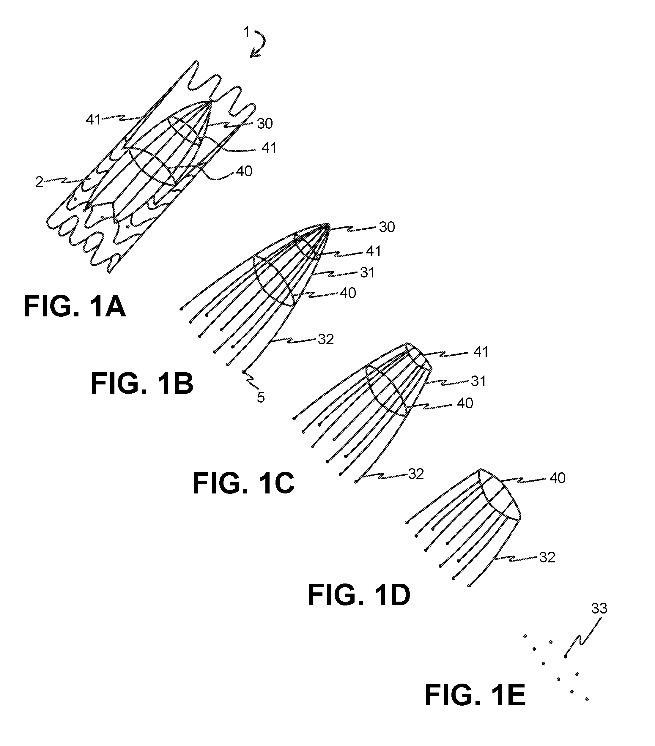 Absorbable vascular filter