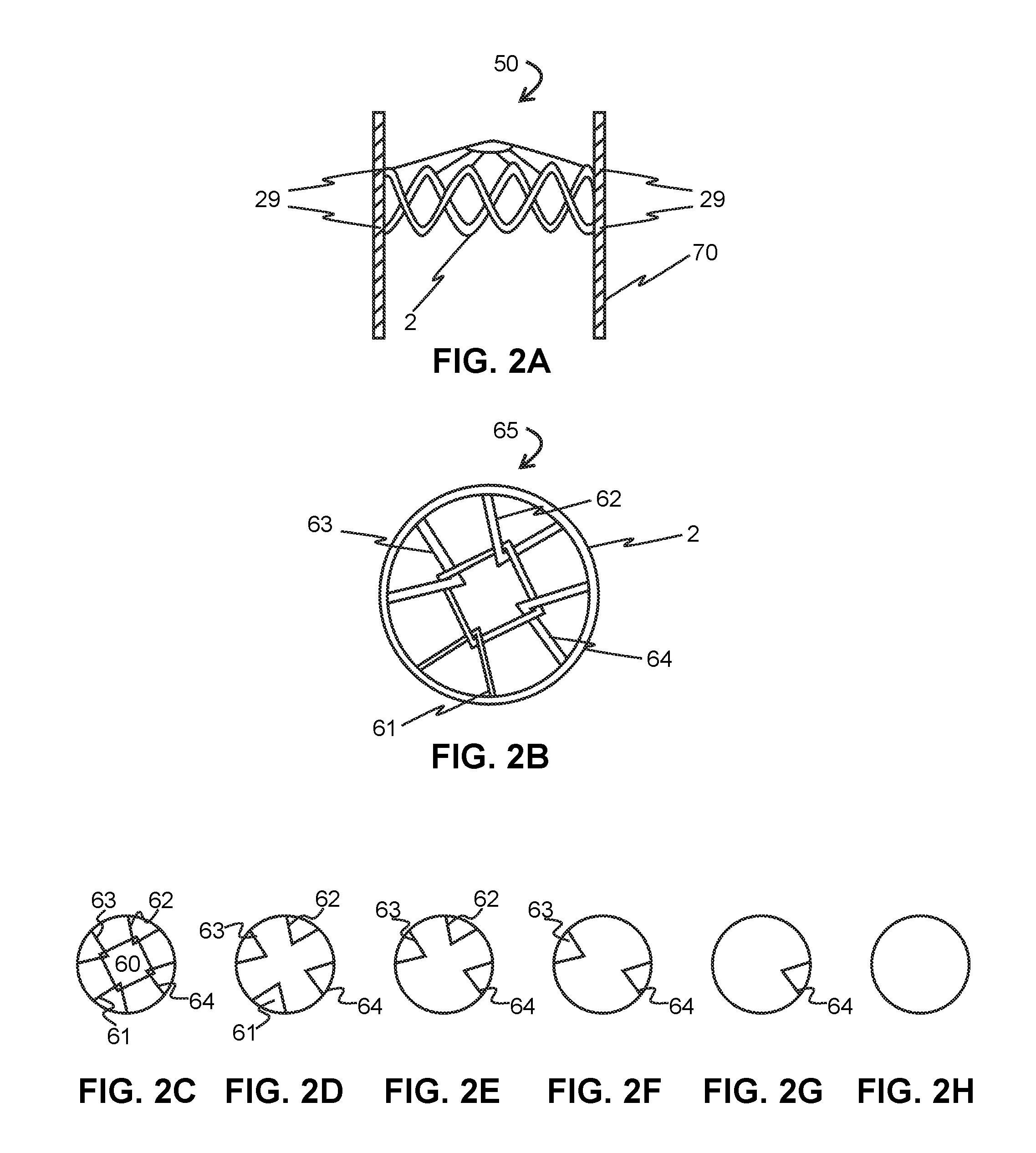 Absorbable vascular filter