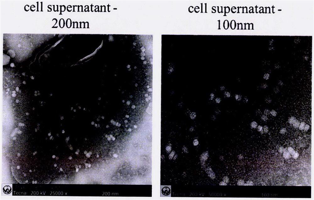 Construction and application of a hunov GII.4 clinical isolate sequence and its infectious clone