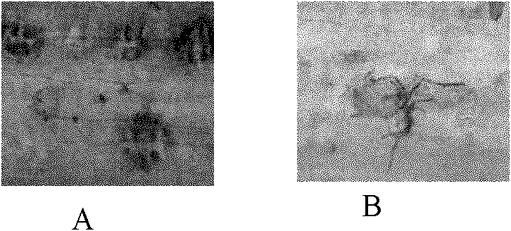 Powdery mildew resistance-related protein TaWRKY1 and coding gene thereof