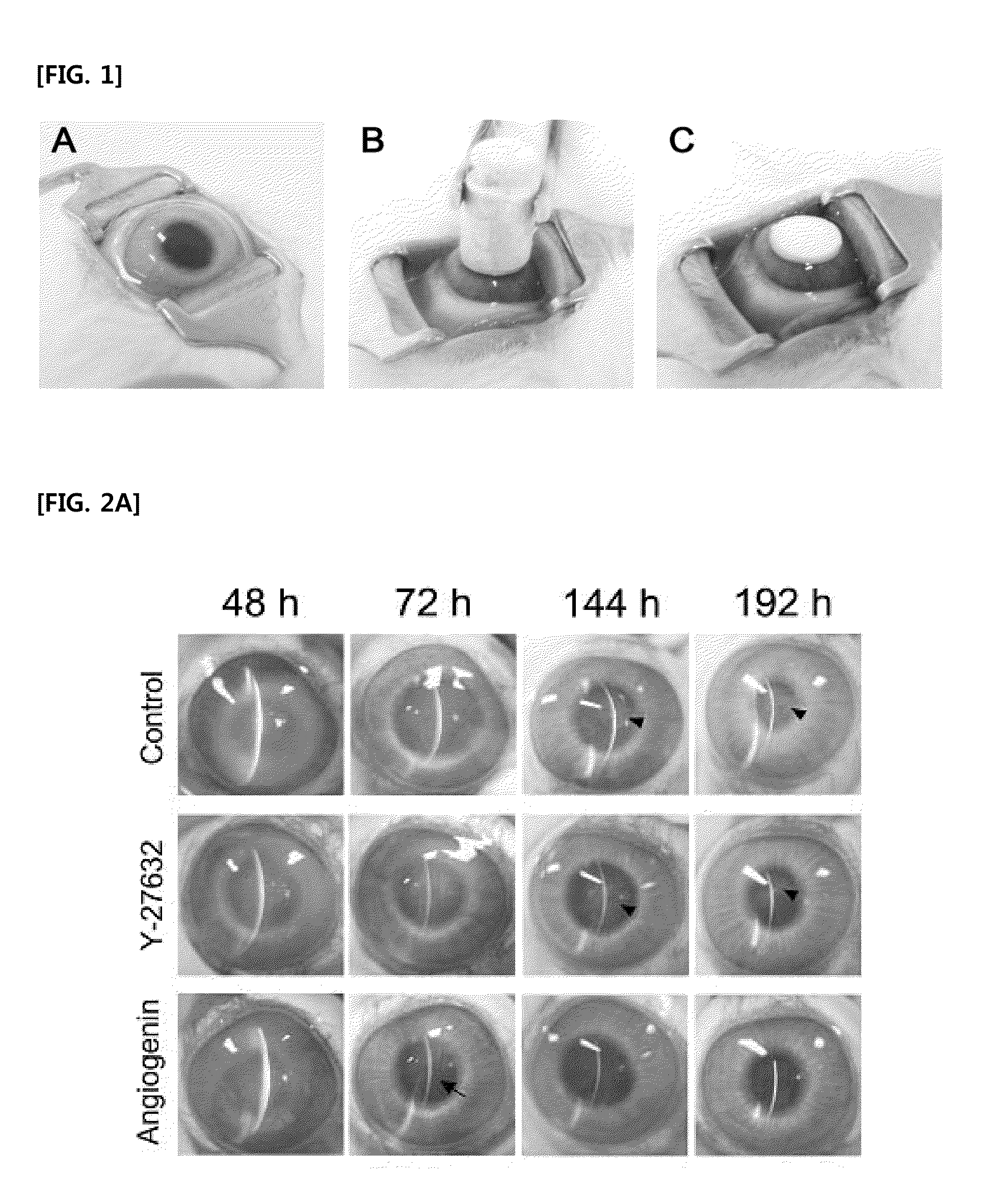 Pharmaceutical composition for treatment of corneal endothelial wounds containing angiogenin