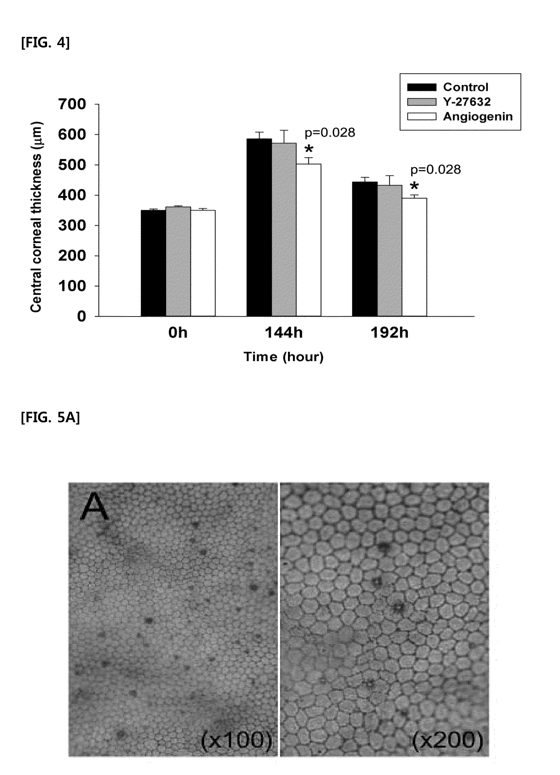 Pharmaceutical composition for treatment of corneal endothelial wounds containing angiogenin