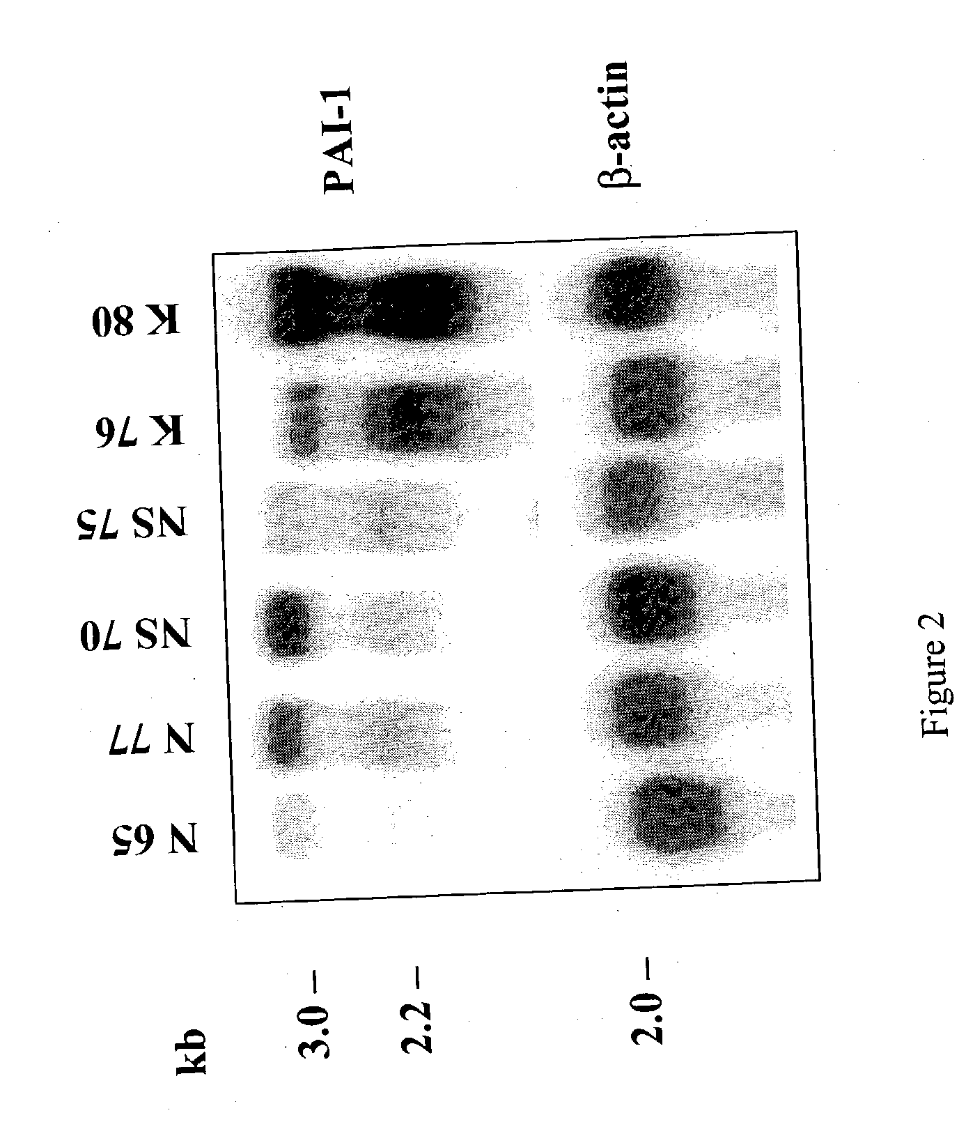 Treatment and prevention of abnormal scar formation in keloids and other cutaneous or internal wounds or lesions