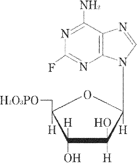 Fludarabine phosphate freeze-dried powder injection and preparation method thereof