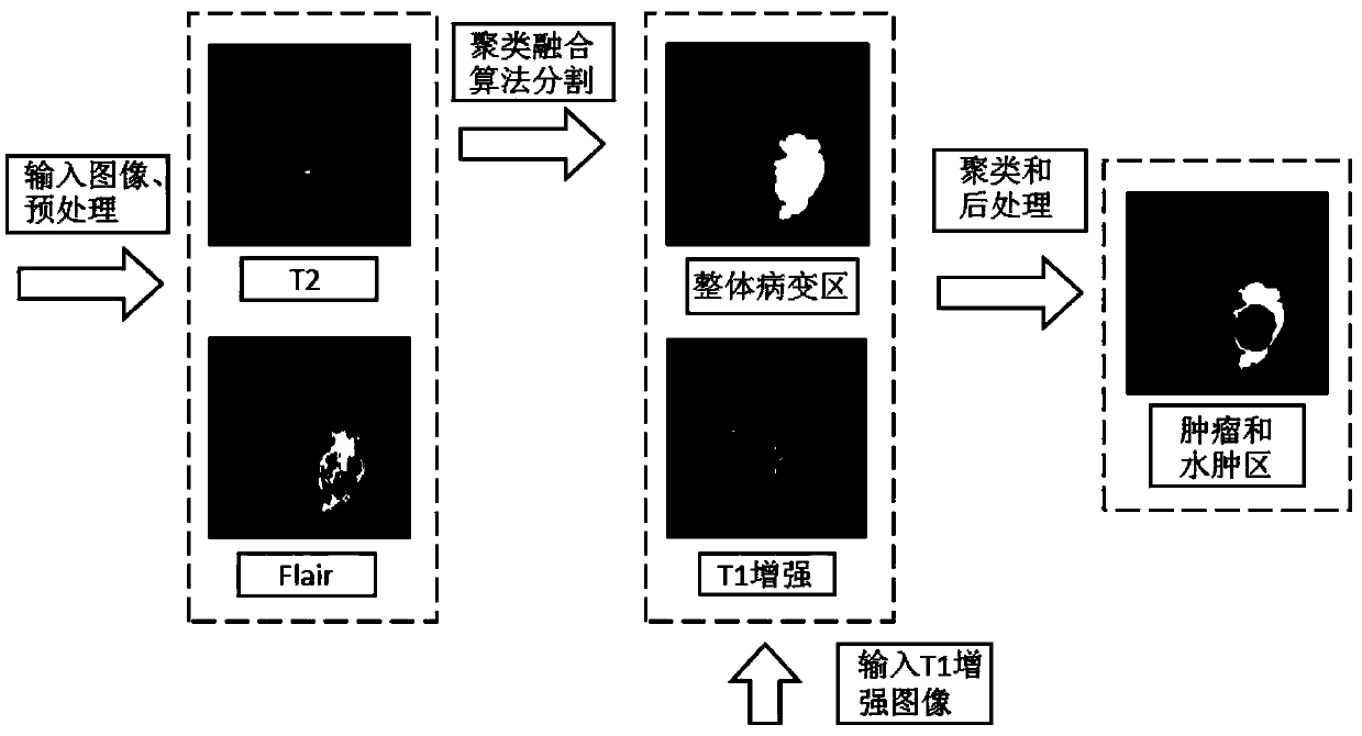 An unsupervised segmentation method for multi-mode brain tumor MRI