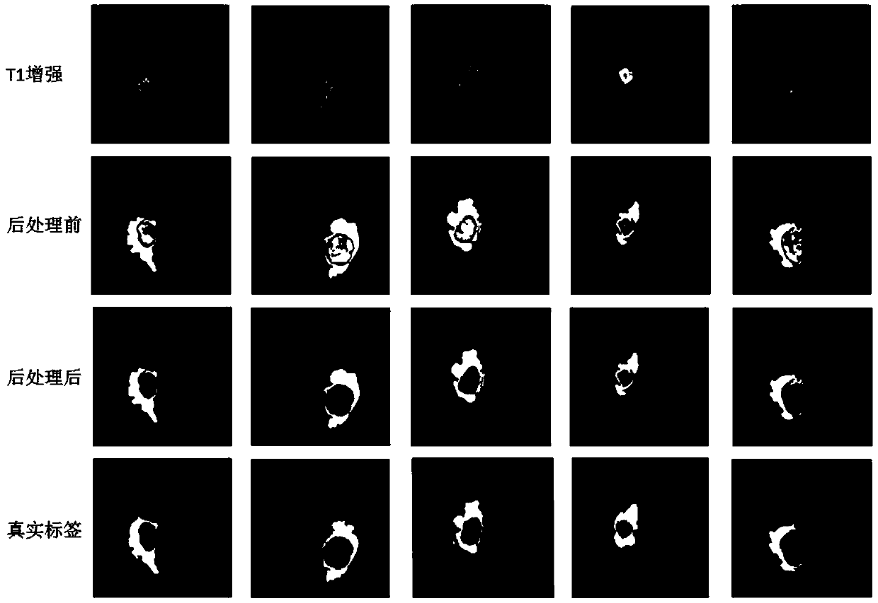 An unsupervised segmentation method for multi-mode brain tumor MRI