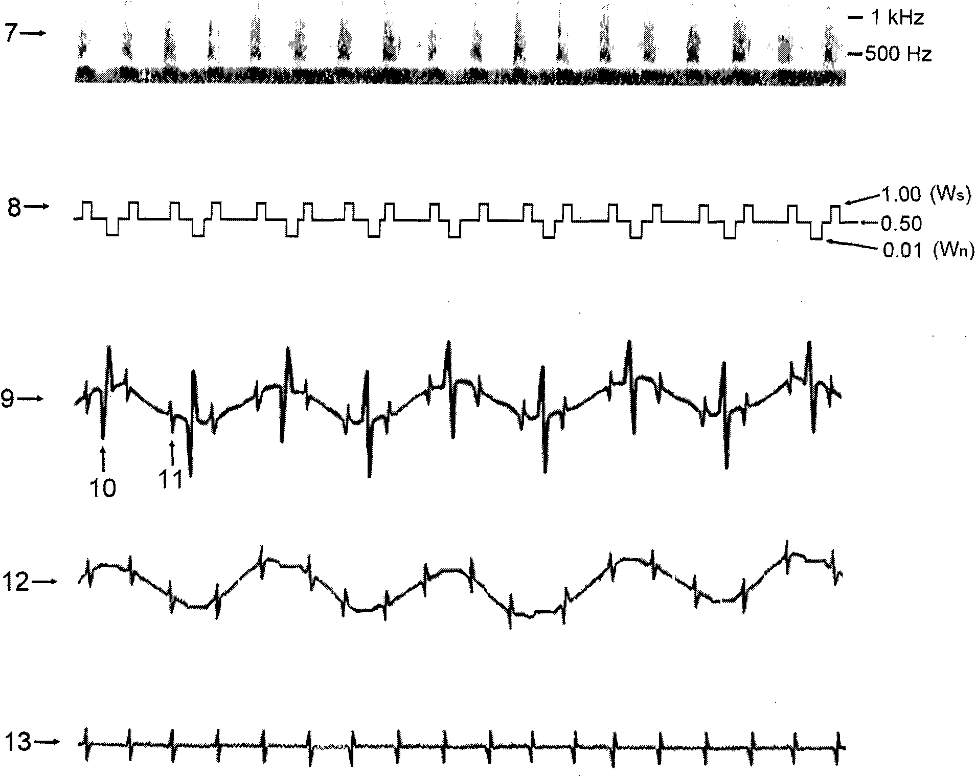 Technology for recording and processing sound signal and electric signal of heart of fetus