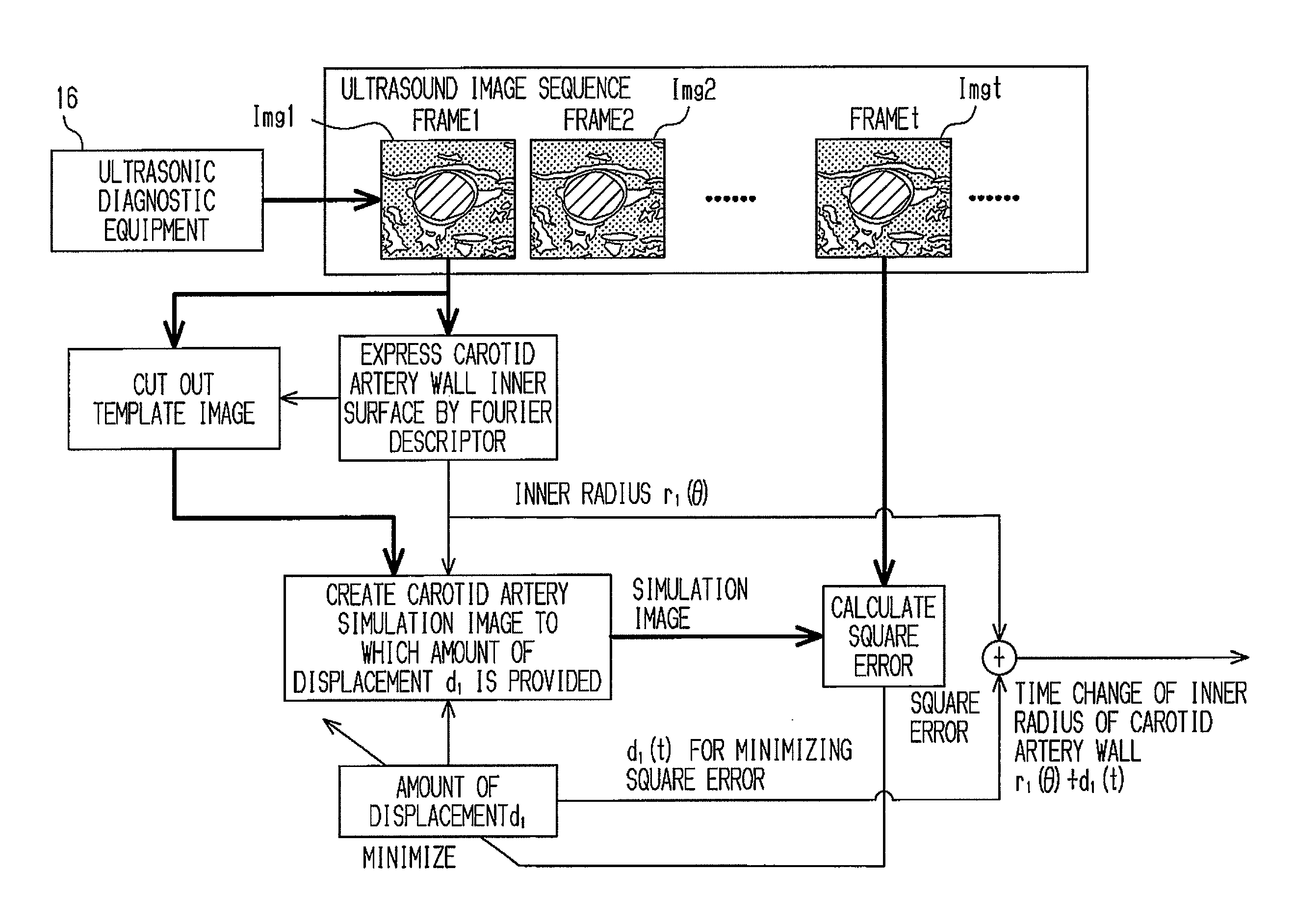 Image processing apparatus, image processing program, storage medium and ultra-sonograph