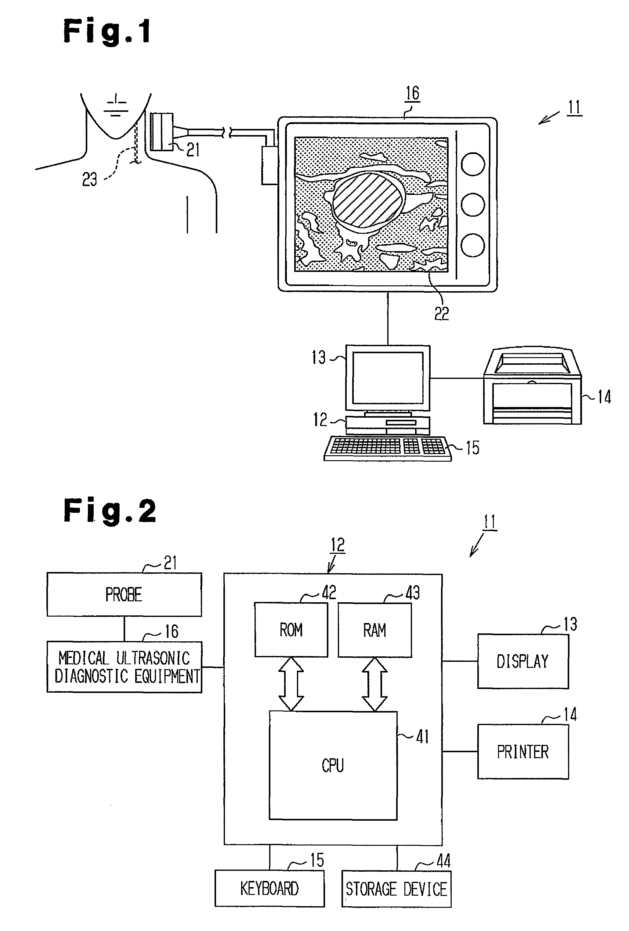 Image processing apparatus, image processing program, storage medium and ultra-sonograph