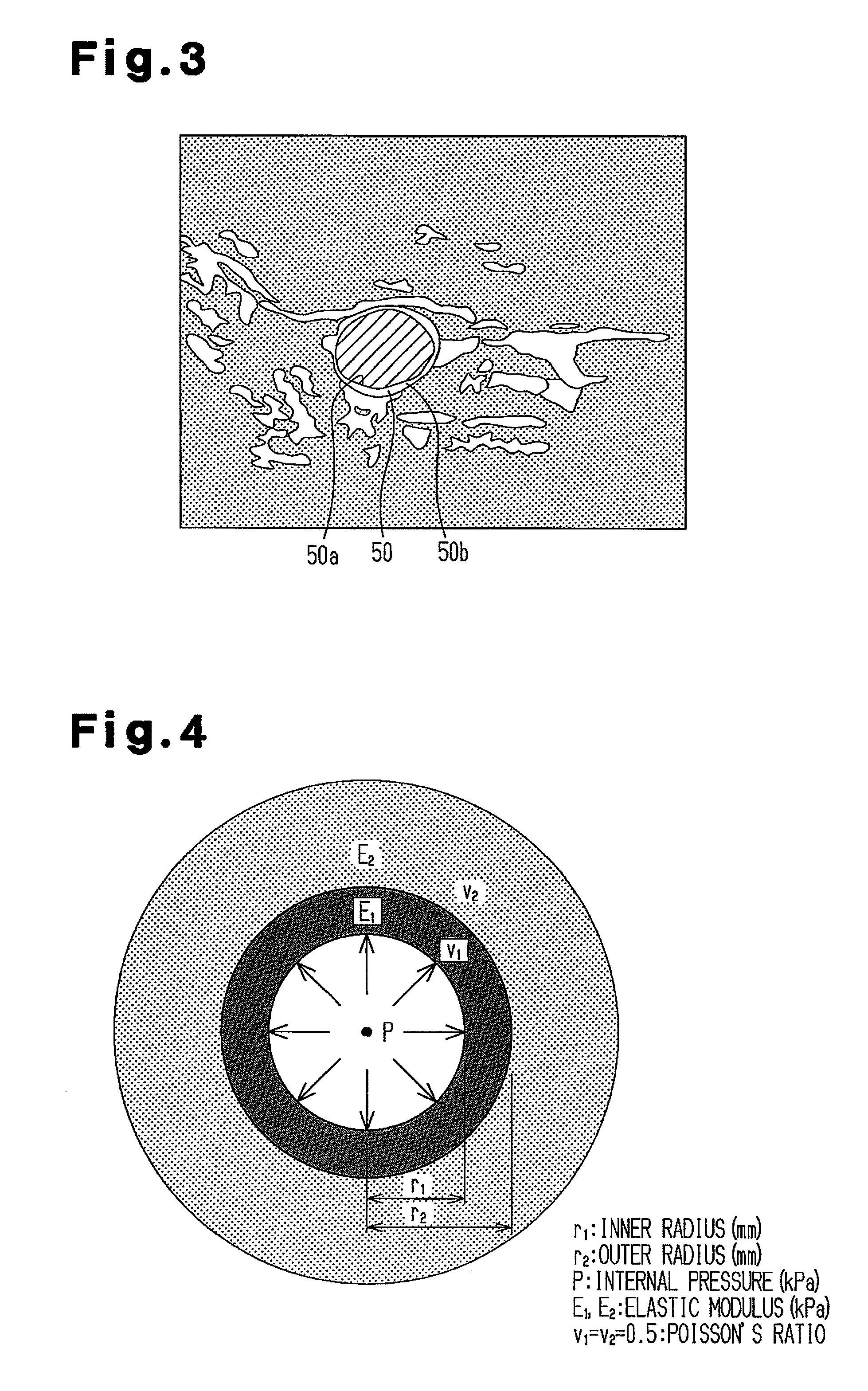 Image processing apparatus, image processing program, storage medium and ultra-sonograph