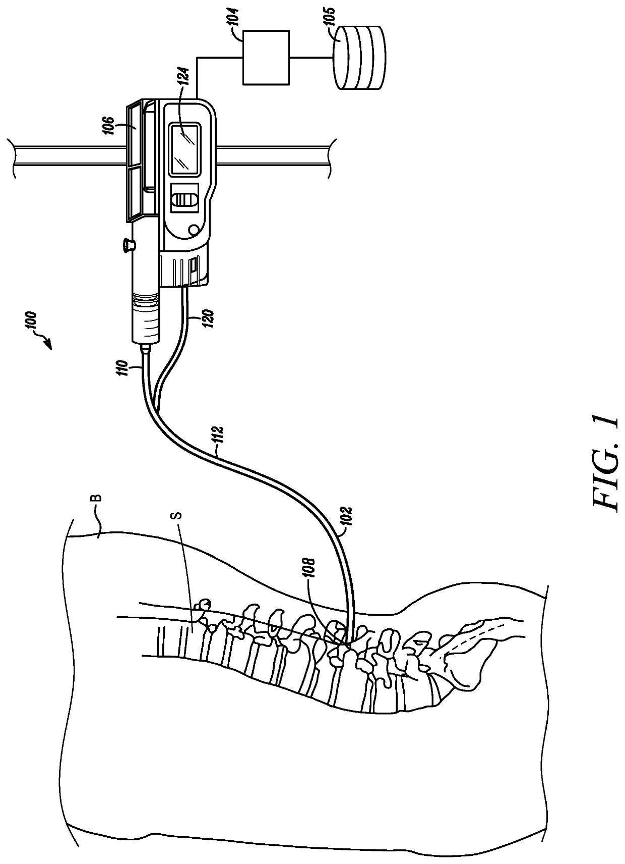 Intrathecal catheter with means to measure quality of drug dispersion