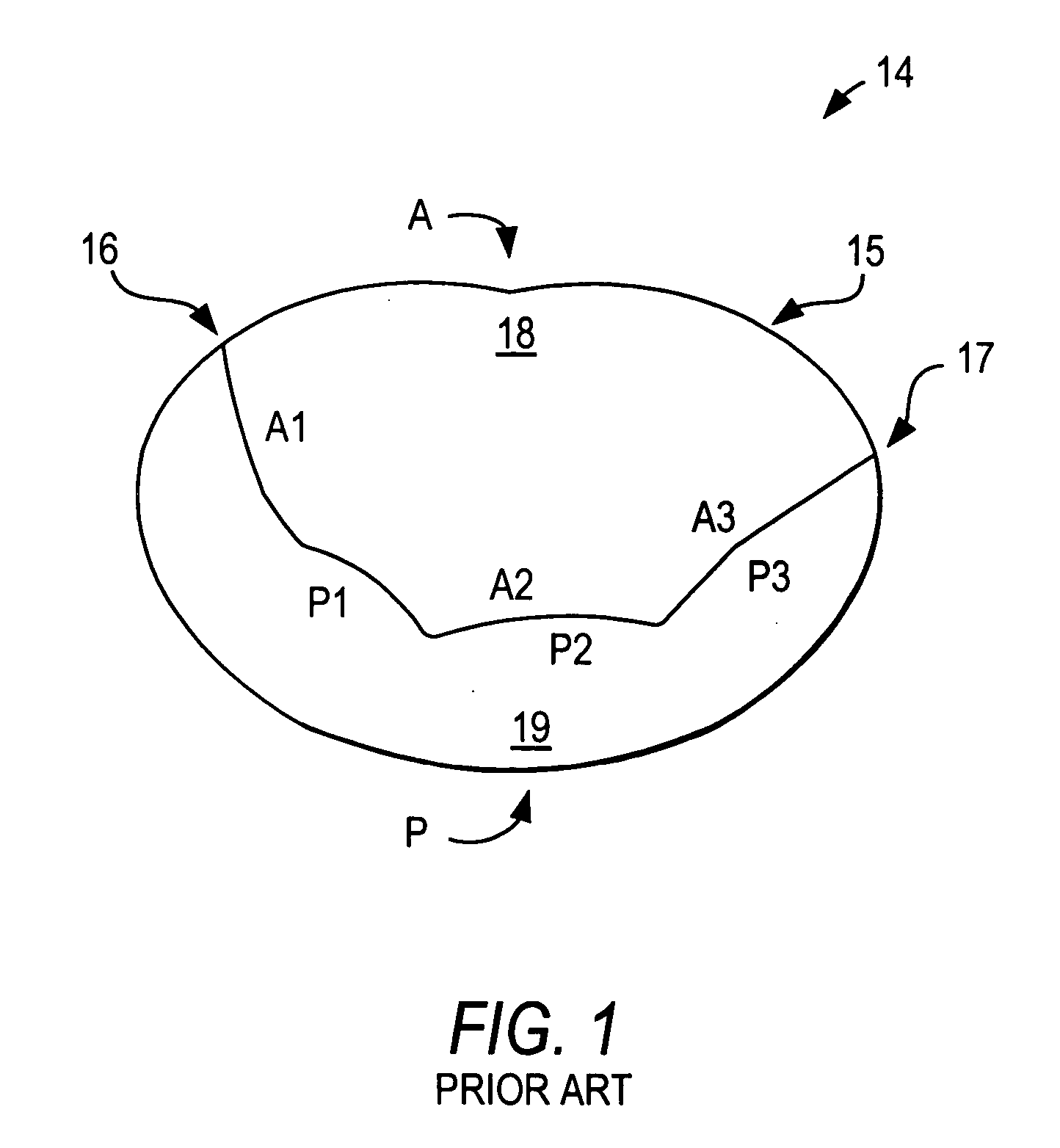 Saddle-shaped mitral valve annuloplasty prostheses with asymmetry, and related methods