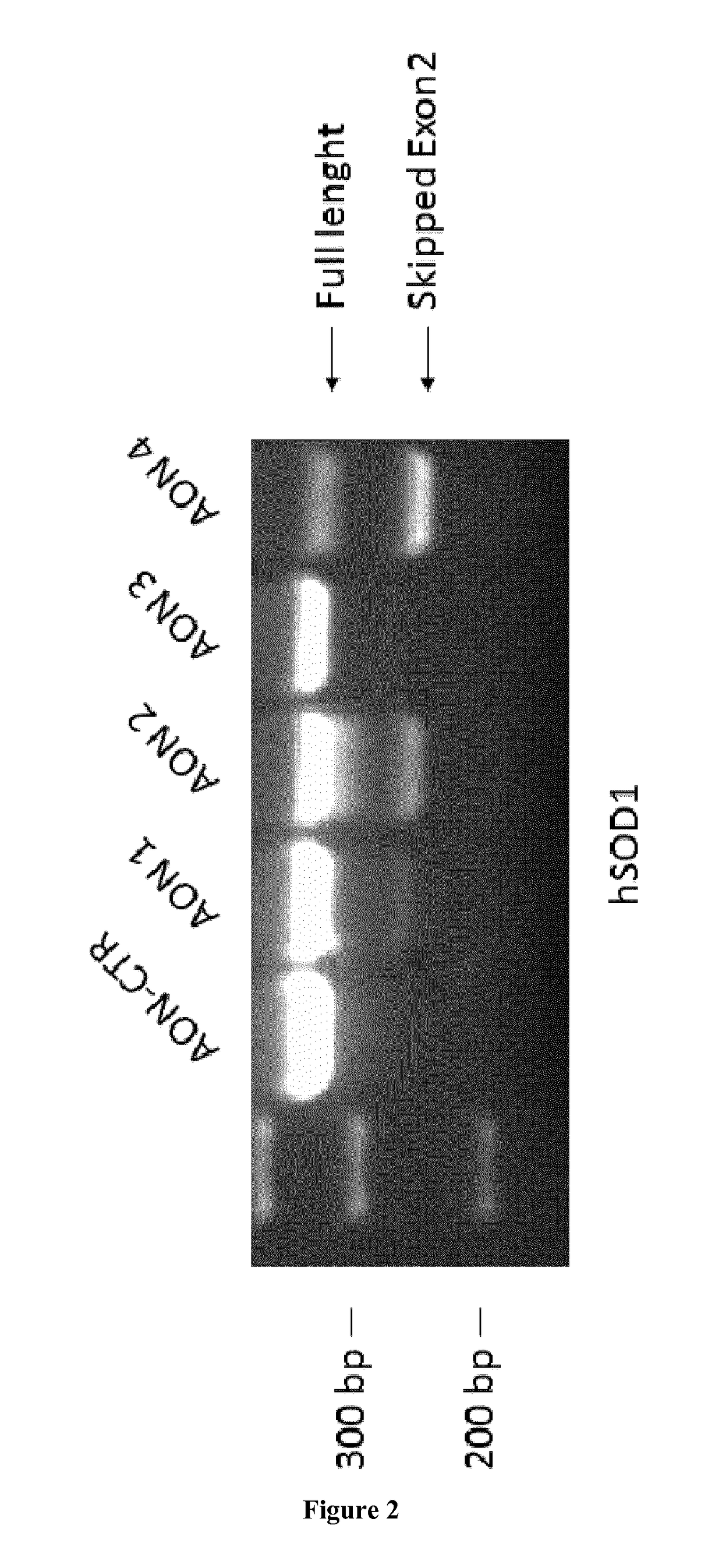 Treatment of amyotrophic lateral sclerosis