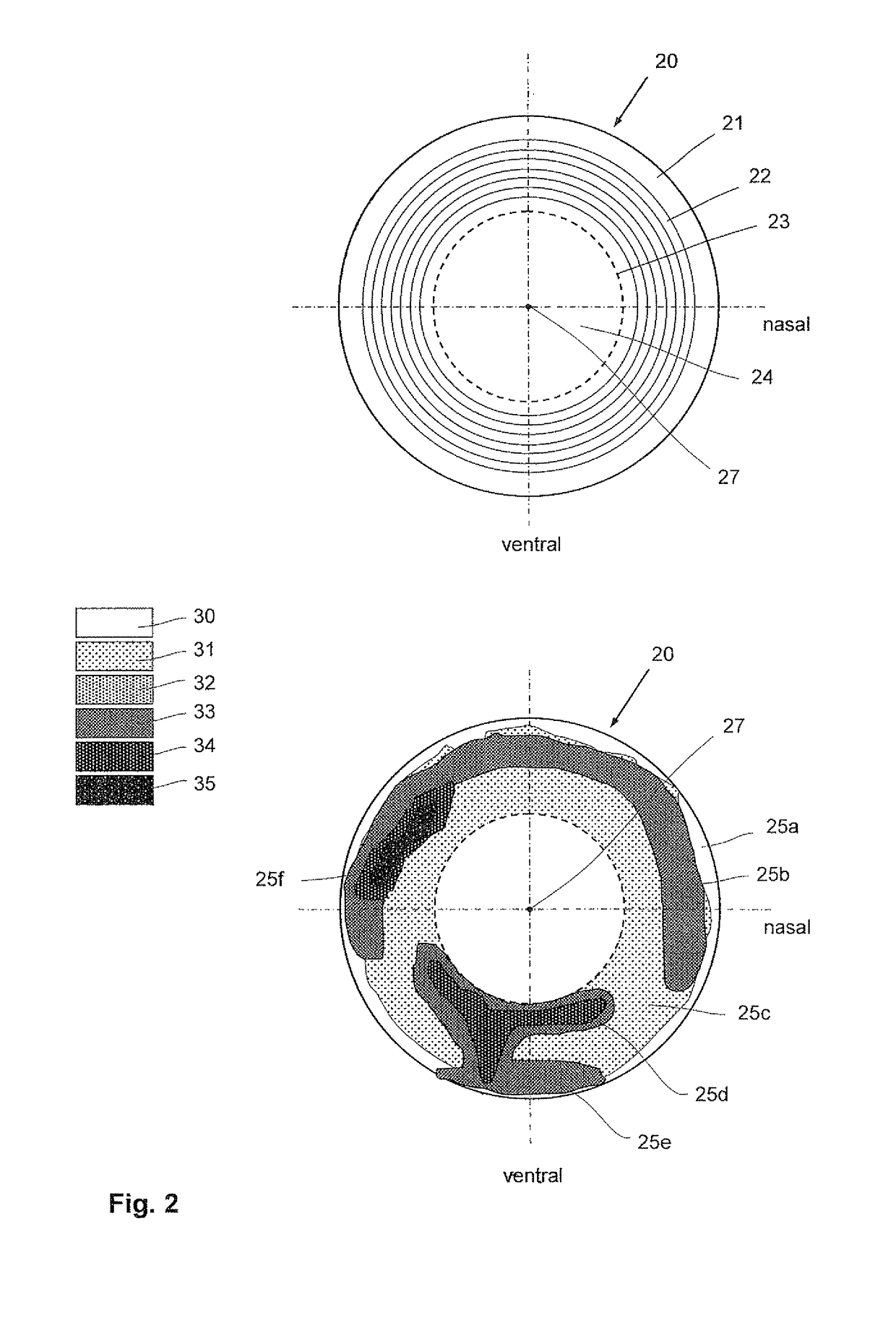 Laser therapy system and method for treatment of a collagen structure and of varicose blood vessels in an eye