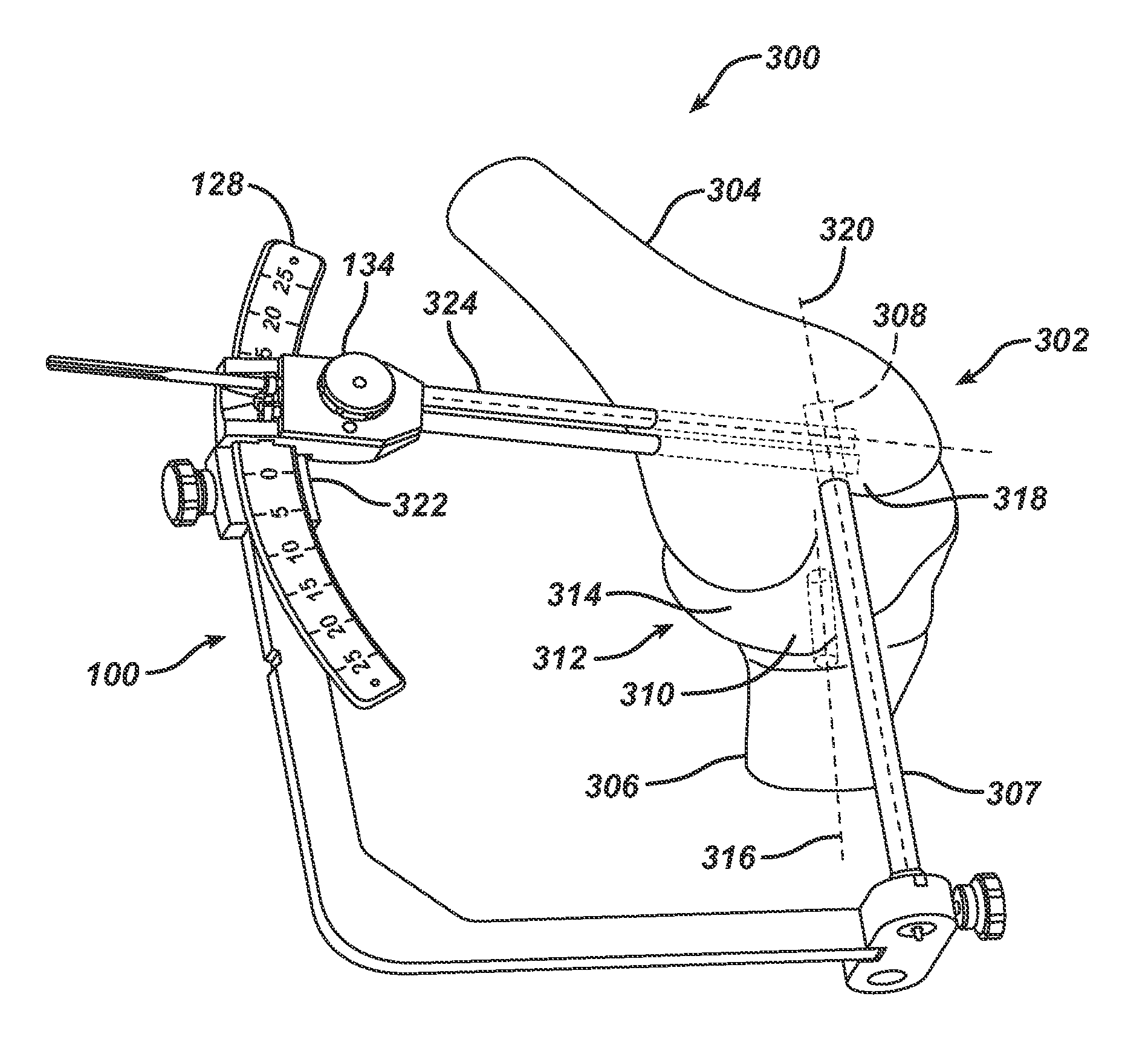 Method for replacing a ligament in a knee