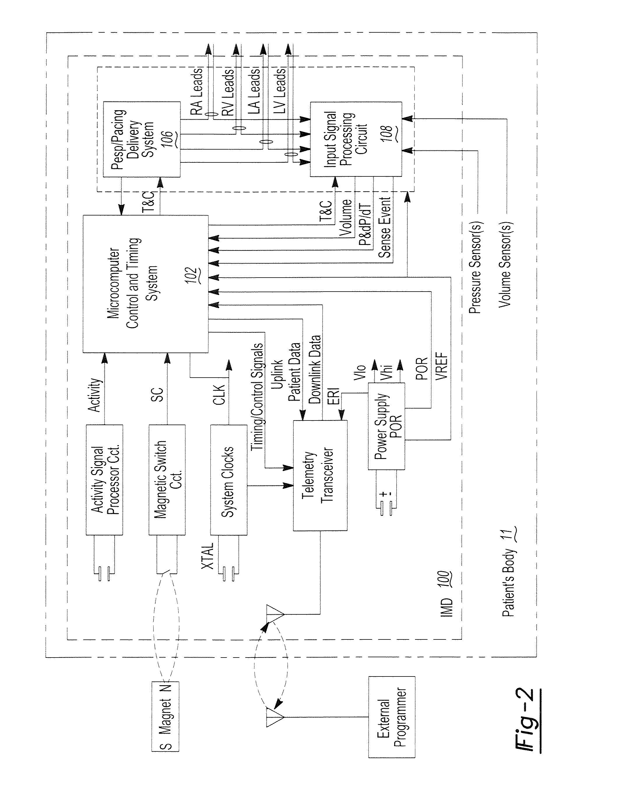 Chronically-implantable active fixation medical electrical leads and related methods for non-fluoroscopic implantation