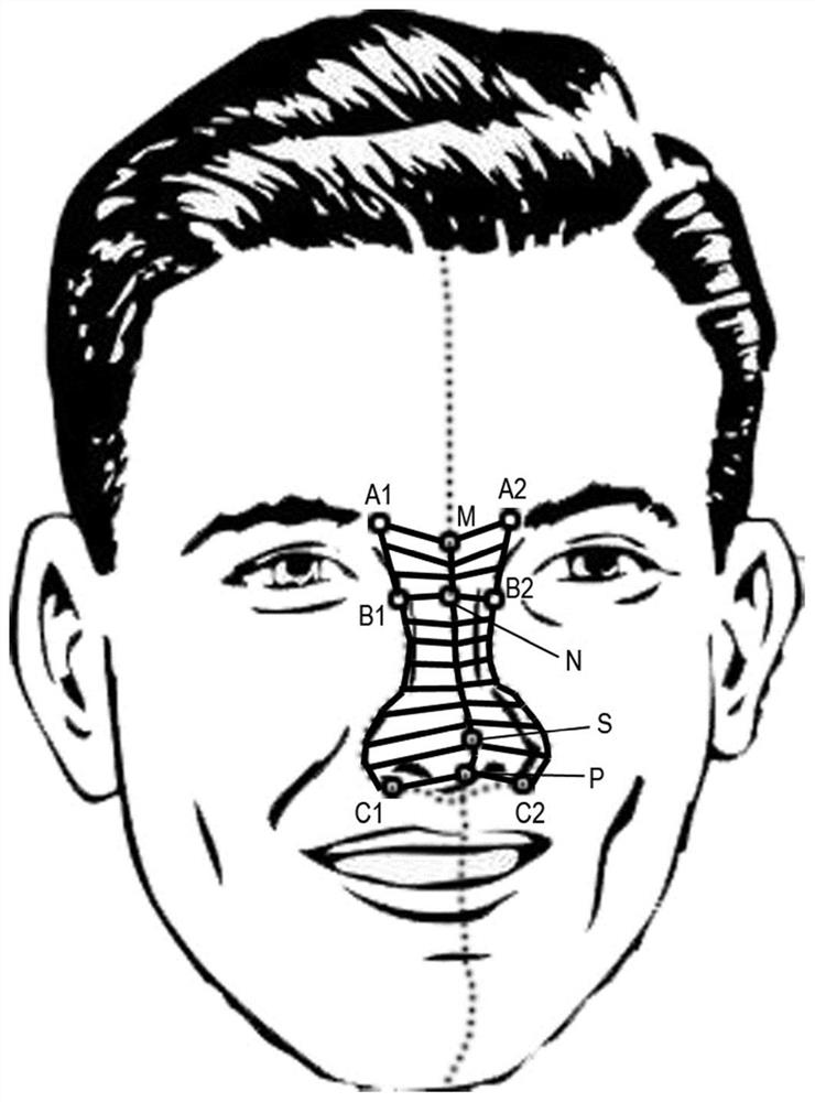 Face Image Rhinoplasty Method and Device