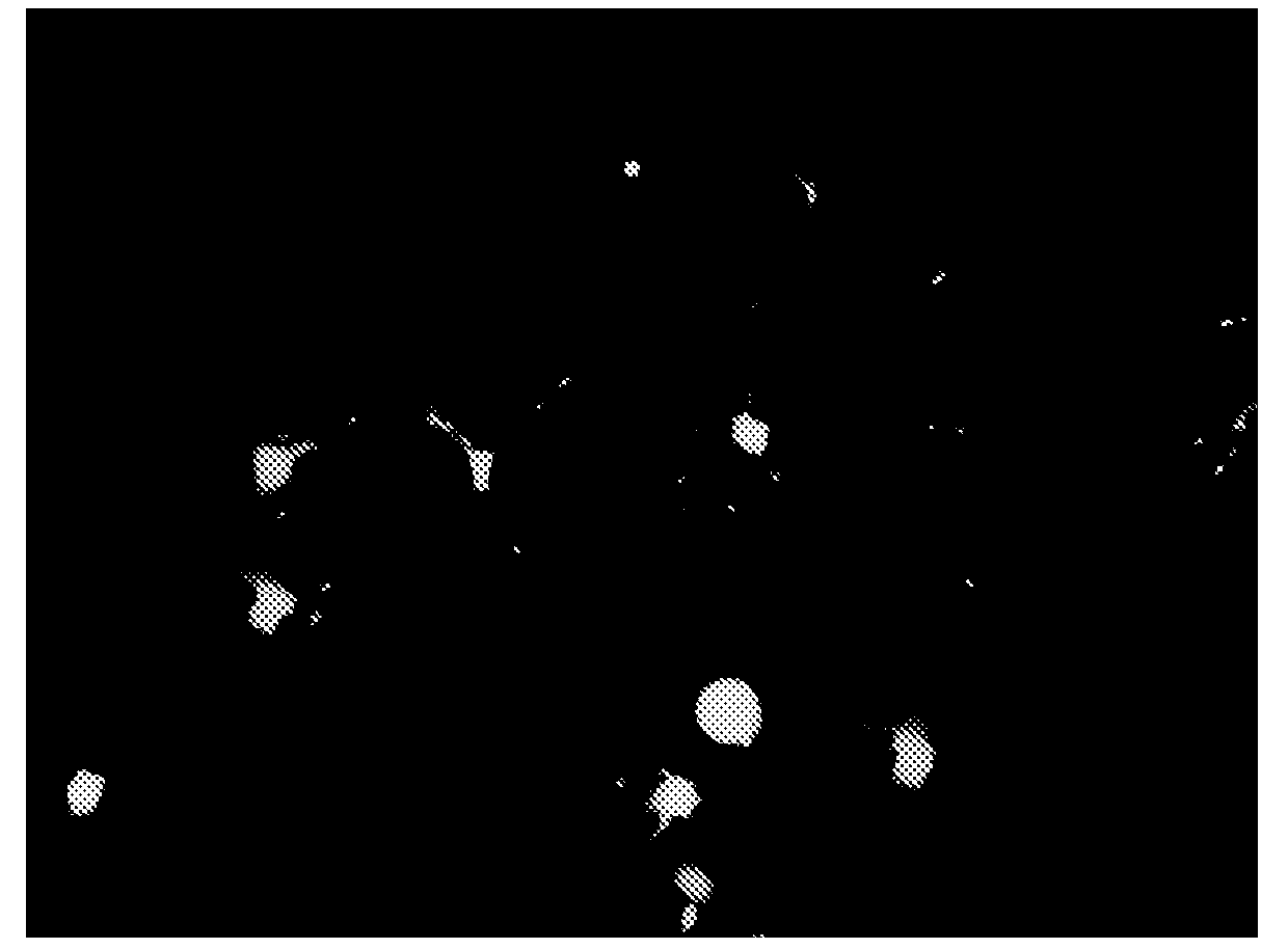 Nutritional compositions containing a neurologic component and uses thereof