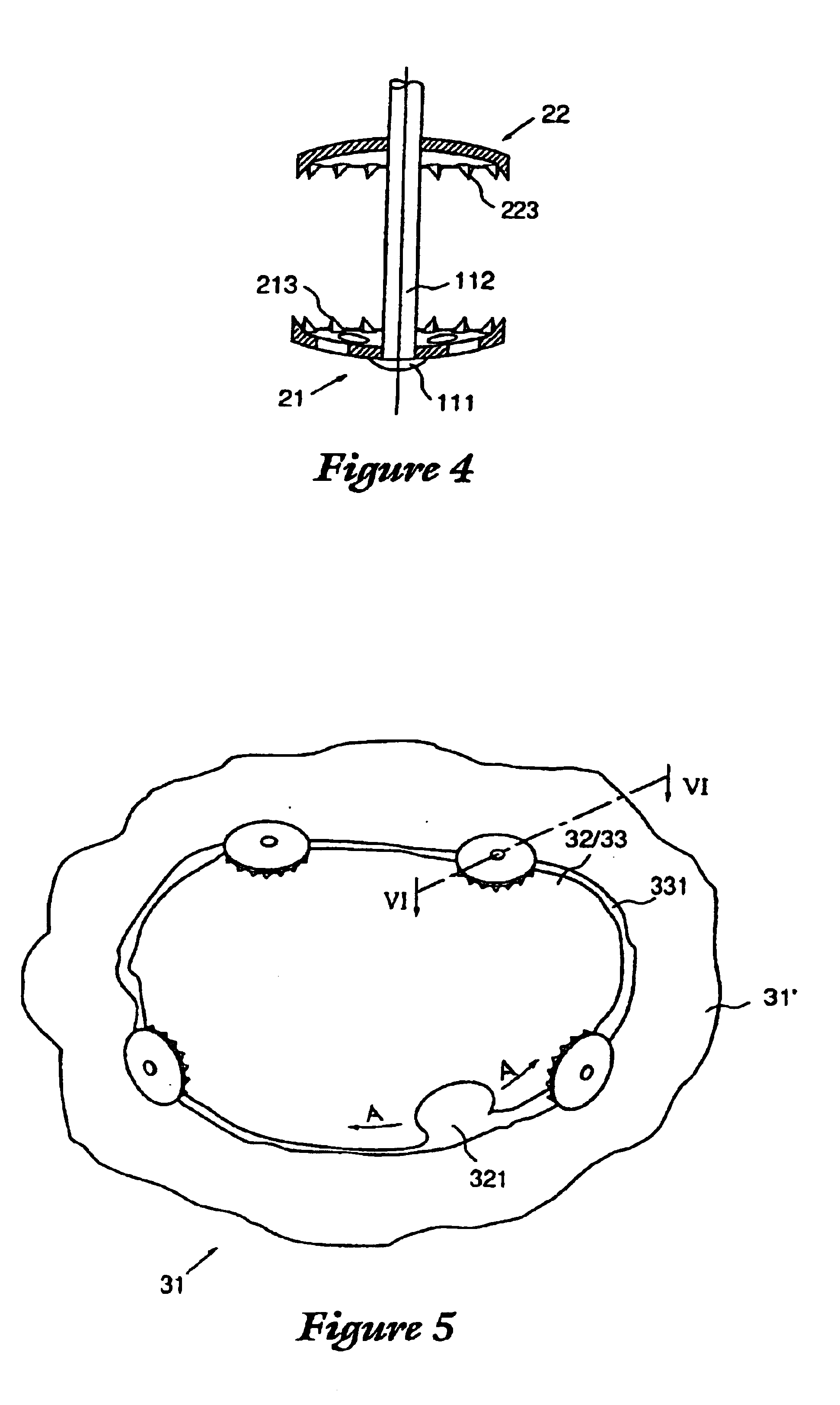 Device for postoperative fixation back into the cranium of a plug of bone removed therefrom during a surgical operation