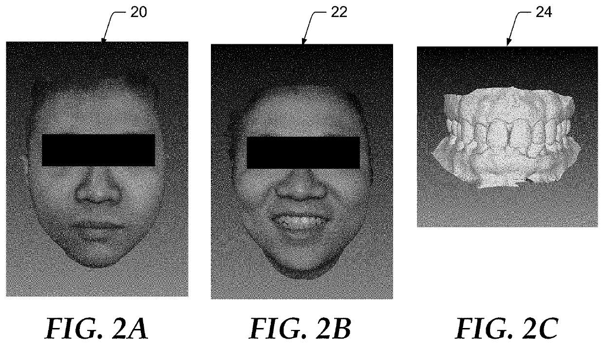 Marker-less alignment of digital 3D face and jaw models