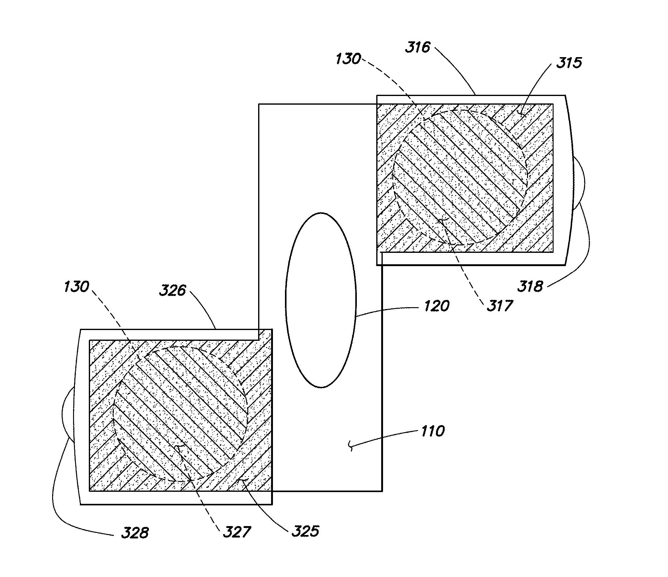 Detection of reduced defibrillation pad contact