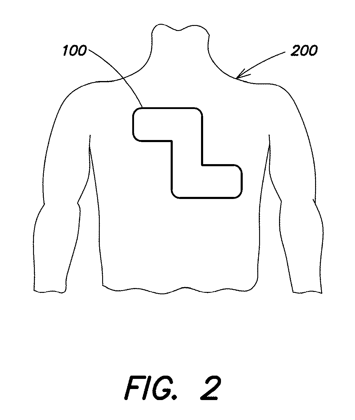 Detection of reduced defibrillation pad contact