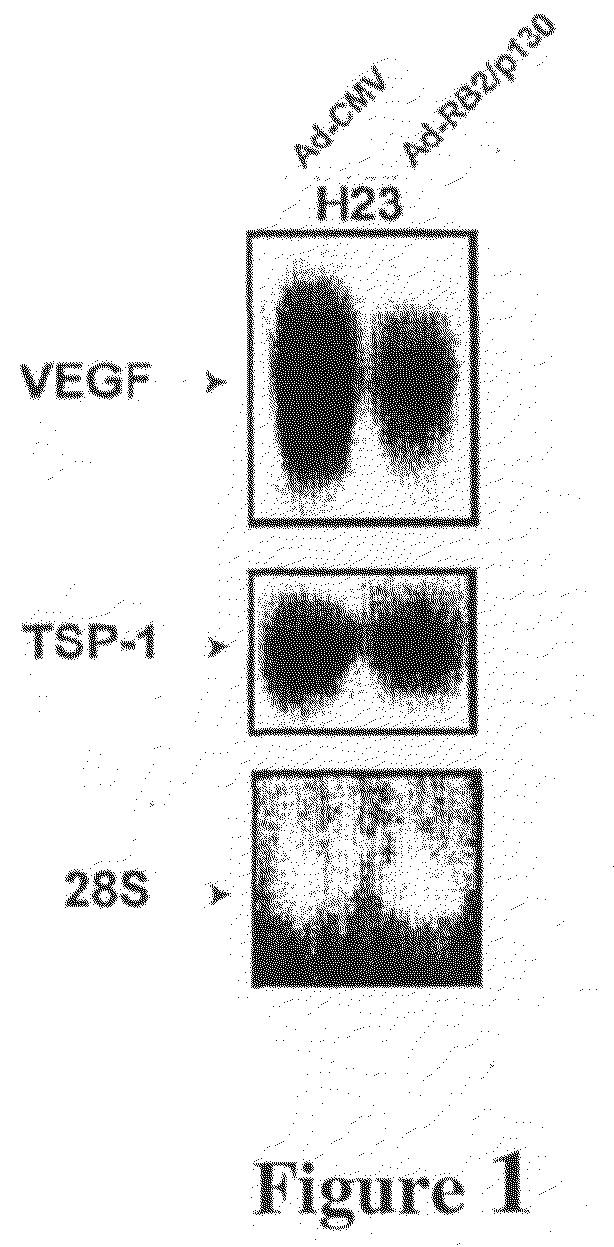 Inhibition of pathological angiogenesis in vivo