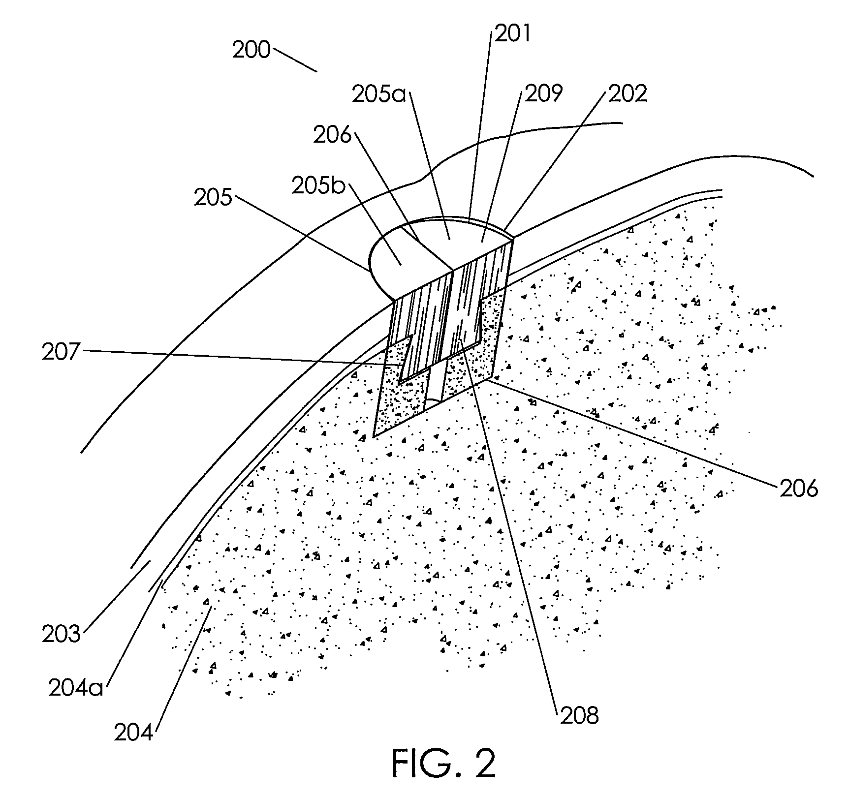 Assembled Cartilage Repair Graft