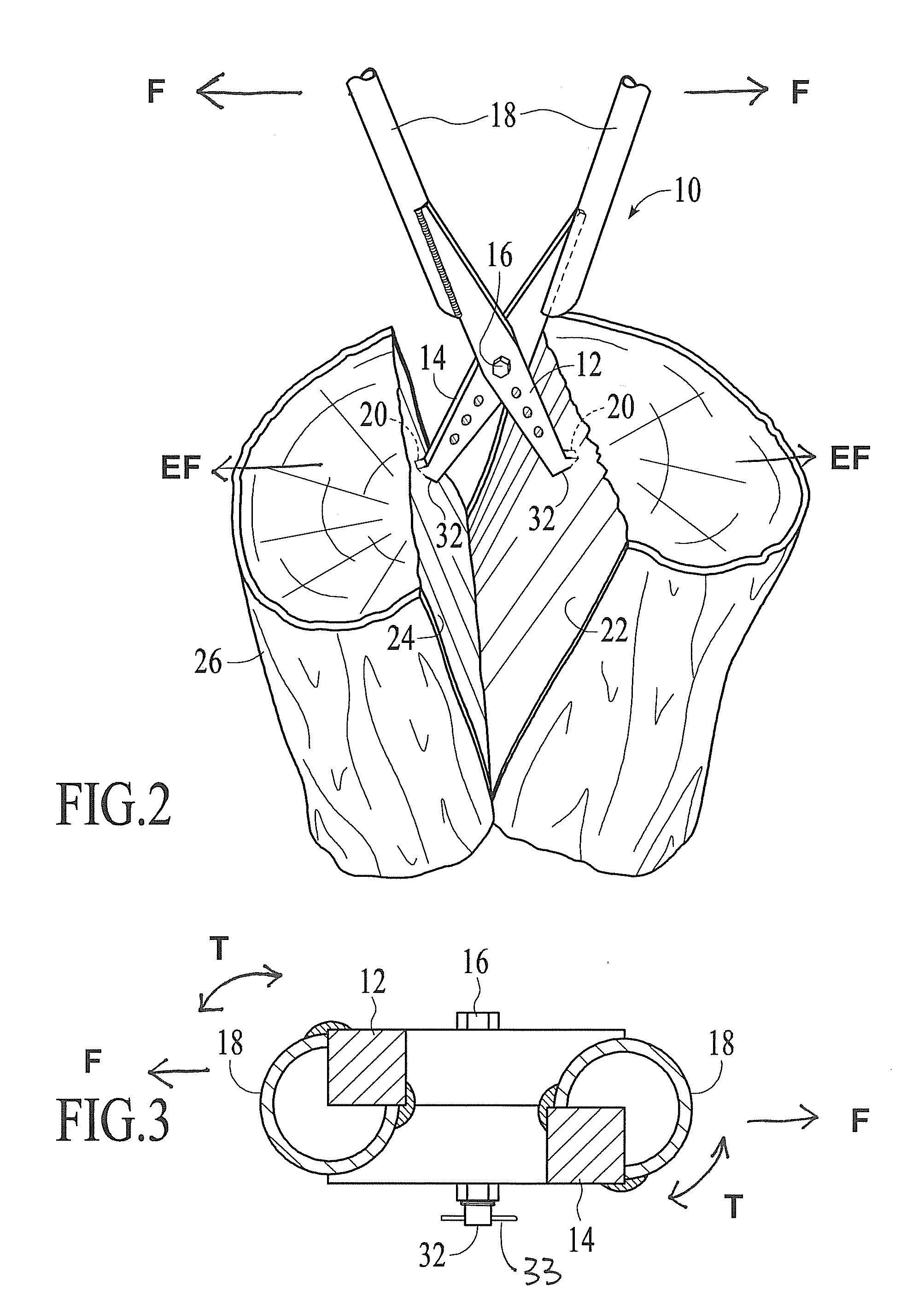 Manually Operable Log Splitter