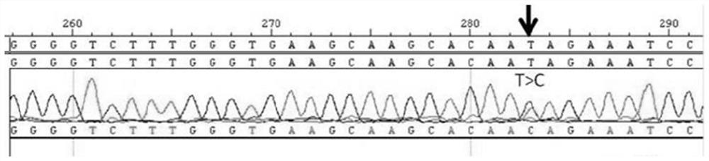 A kit for detecting pathological myopia and its use method and application