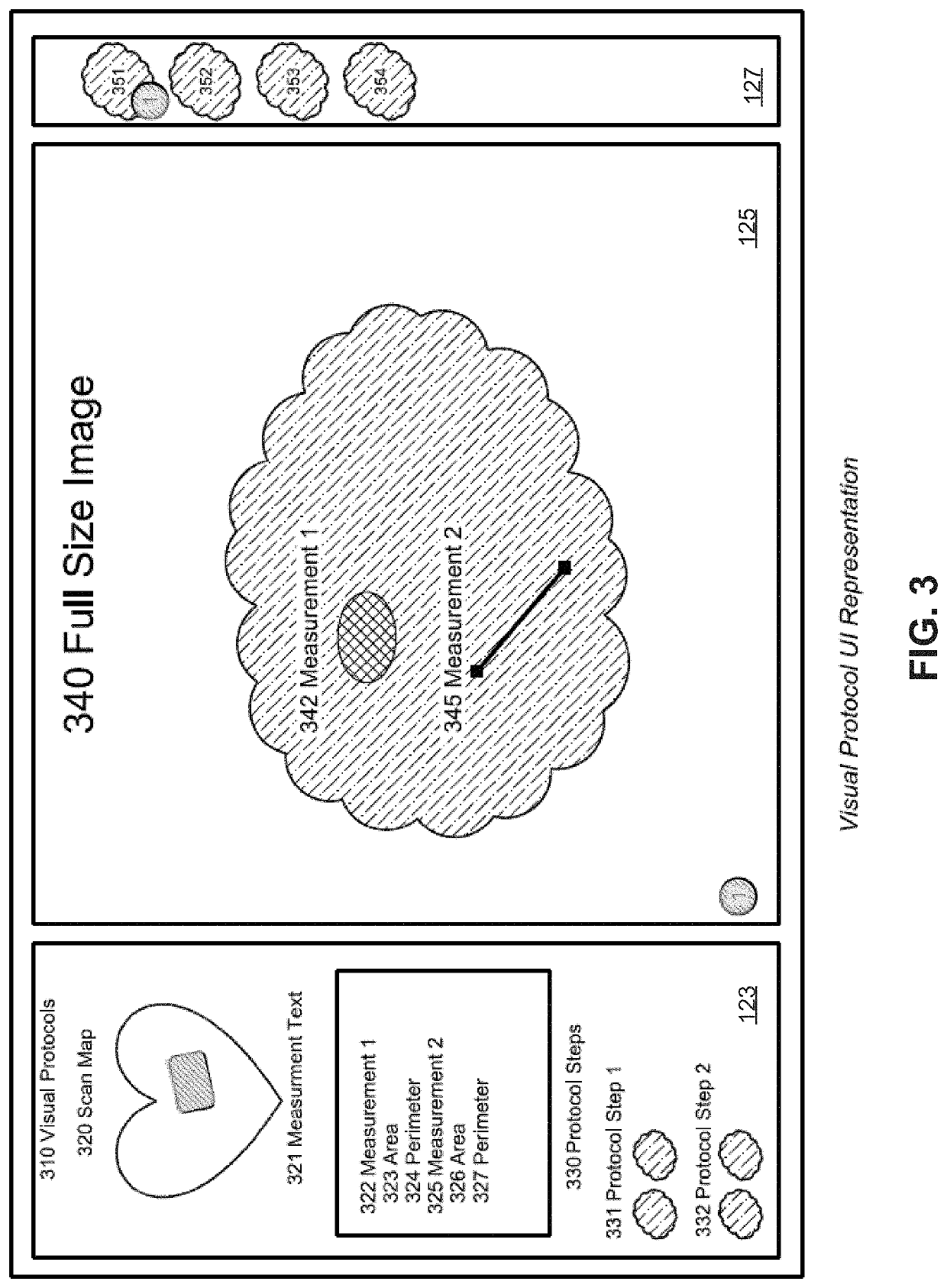 Ultrasound visual protocols