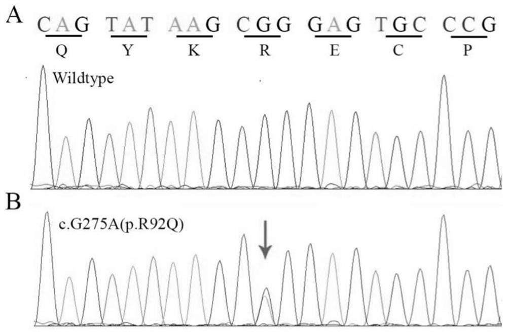 A congenital aniridia screening kit