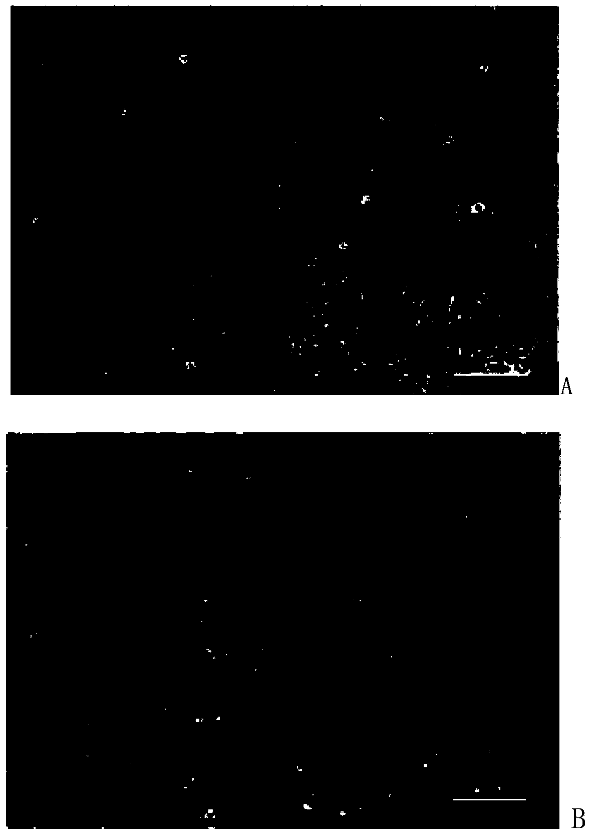 Method for preparing neural stem cells by adopting fibroblasts