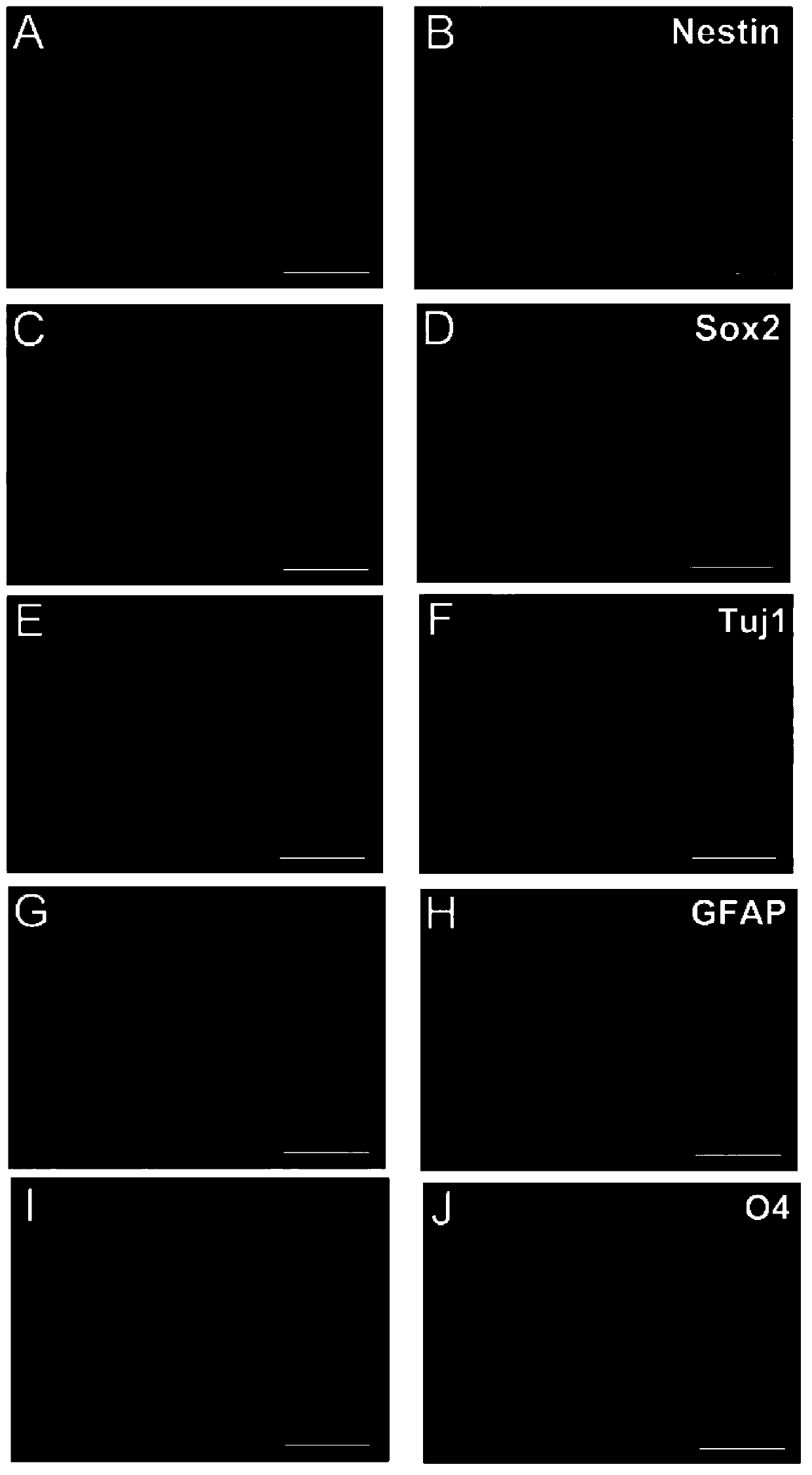 Method for preparing neural stem cells by adopting fibroblasts