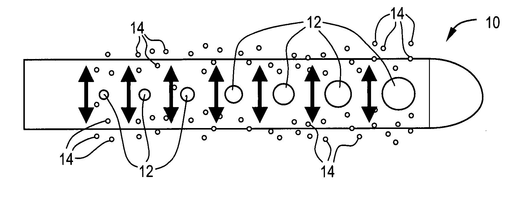 Fluid management flow implants of improved occlusion resistance