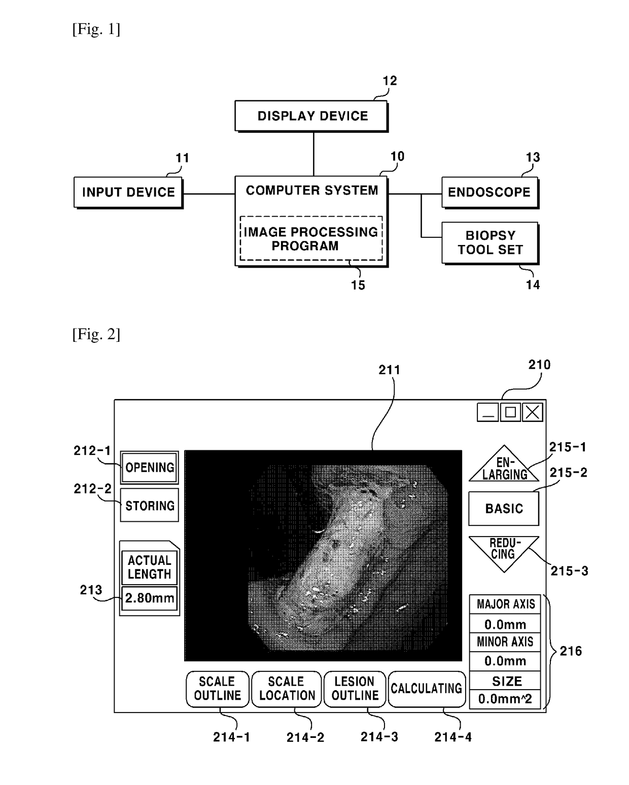 Method for measuring size of lesion which is shown by endoscope, and computer readable recording medium