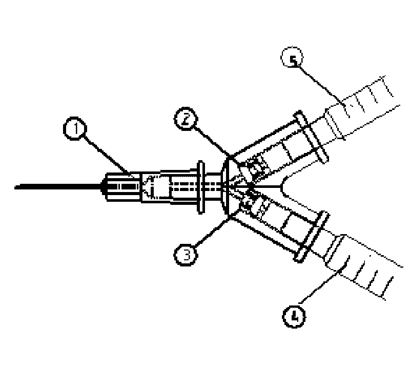 Medical syringe with vitreous cavity