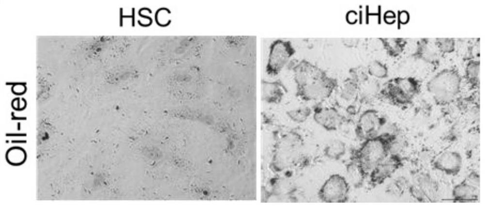 Chemical small molecule composition and method for directly reprogramming in-vitro and in-vivo chemically induced fibroblasts into hepatocytes