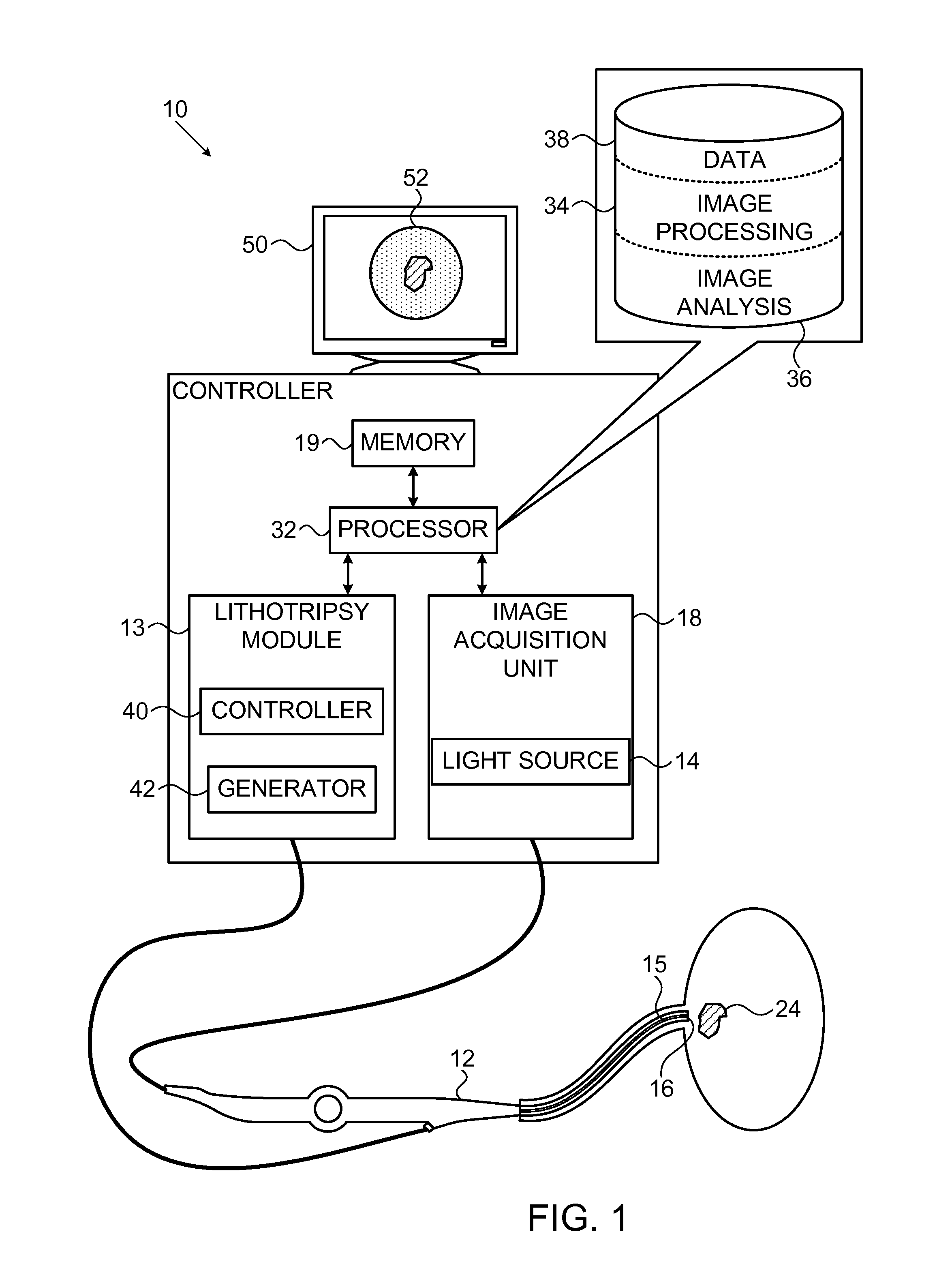 Computer aided image-based enhanced intracorporeal lithotripsy