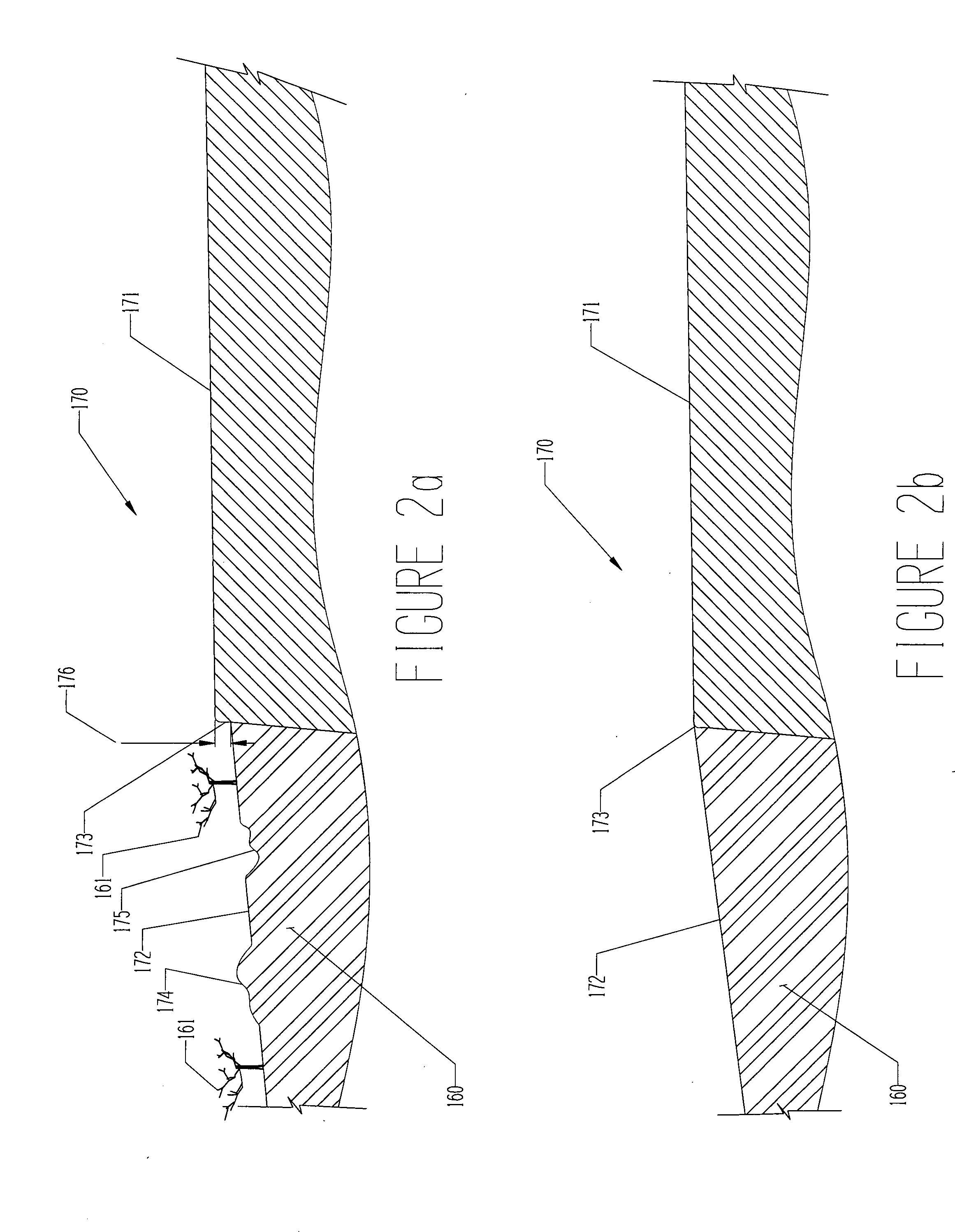 Machine for the maintenance and conditioning of road shoulders