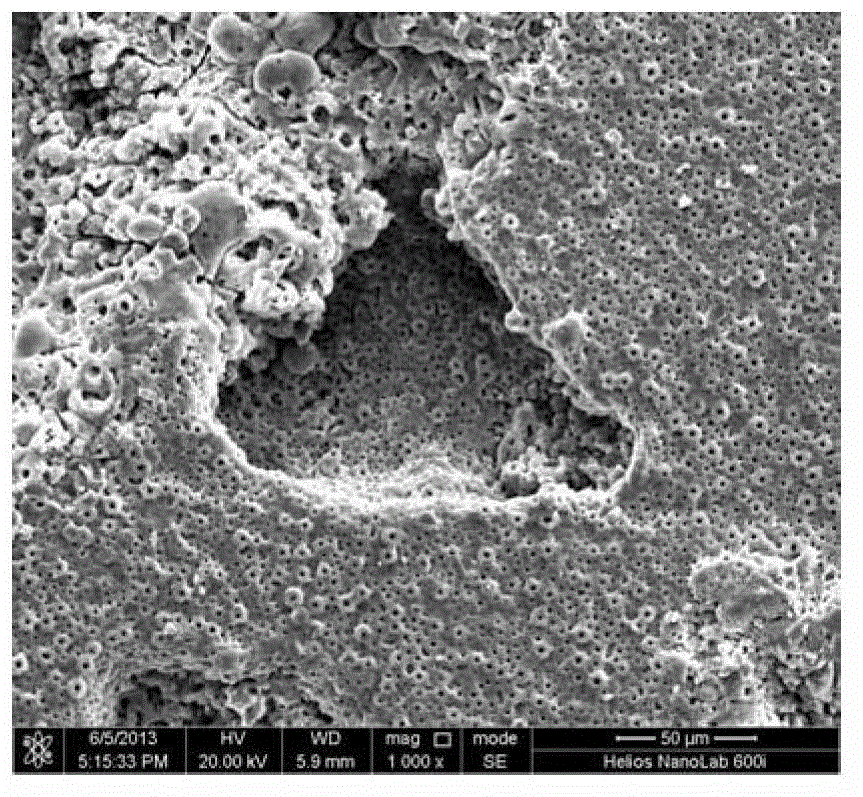 Method for preparing biological activity micro-arc oxidation ceramic coating with macroscopic/microcosmic double-stage pore structure on surface of medical titanium through two-step method