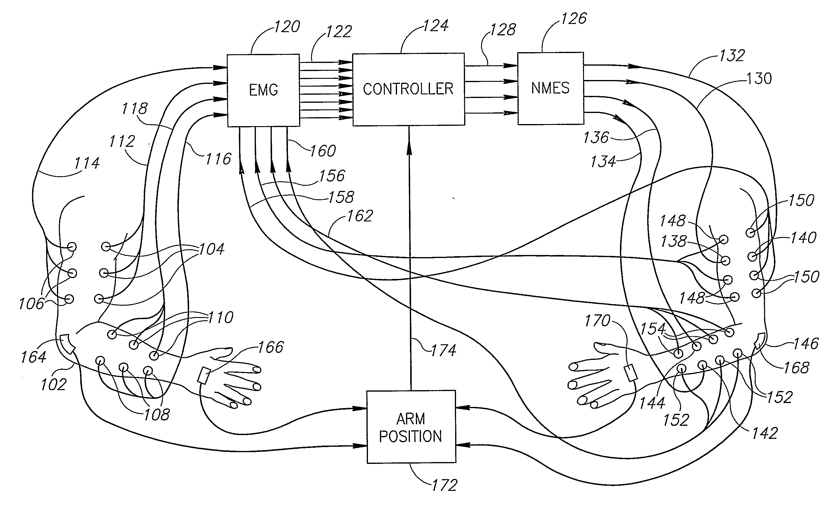 Neuromuscular Stimulation