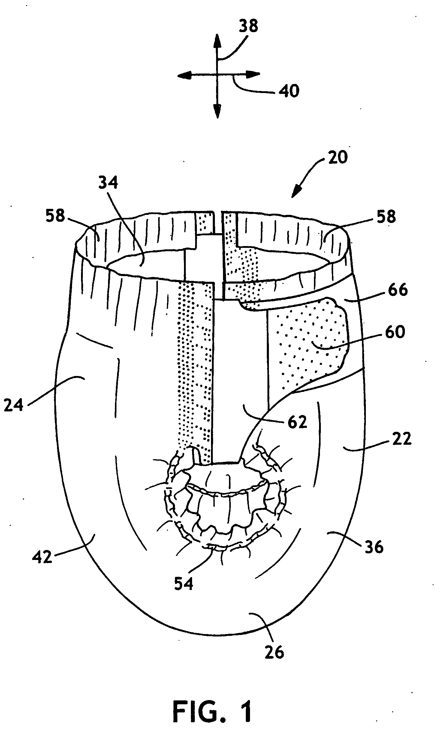 Absorbent article having dual pattern bonding