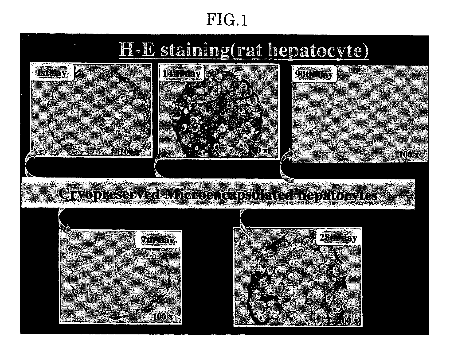 Method for cryopreserving microencapsulated living animal cells enclosed in immunoisolation membranes, such microencapsulated living animal cells in immunoisolation membranes, and biohybrid artificial organ modules using such microencapsulated living animal cells in immunoisolation membranes