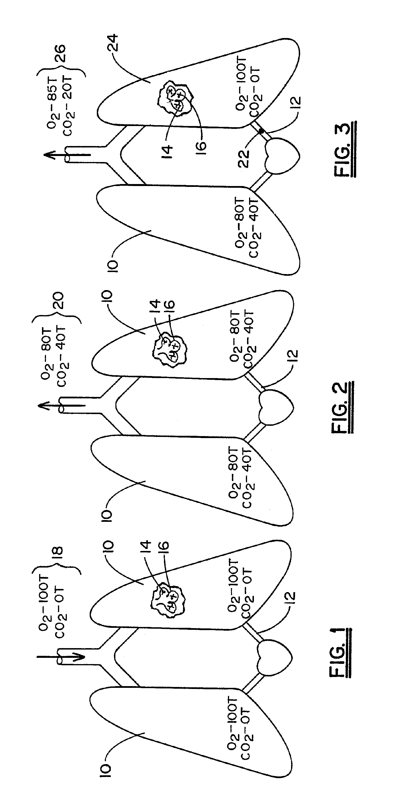 Non-invasive device and method for measuring the cardiac output of a patient