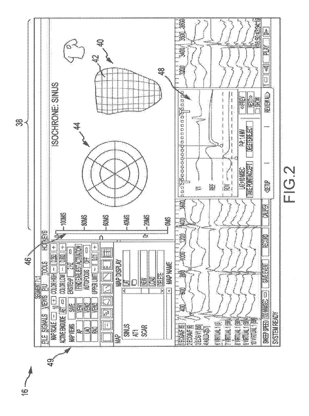 System and method for displaying cardiac mechanical activation patterns