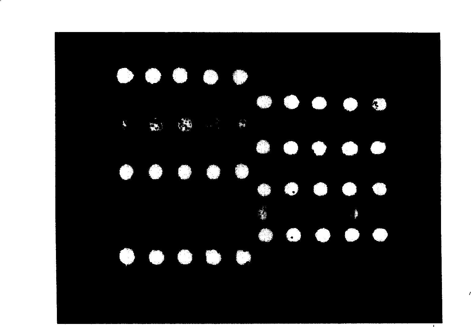 Gene chip for detection of hyperpiesis individual medicine correlated gene mutation and uses thereof