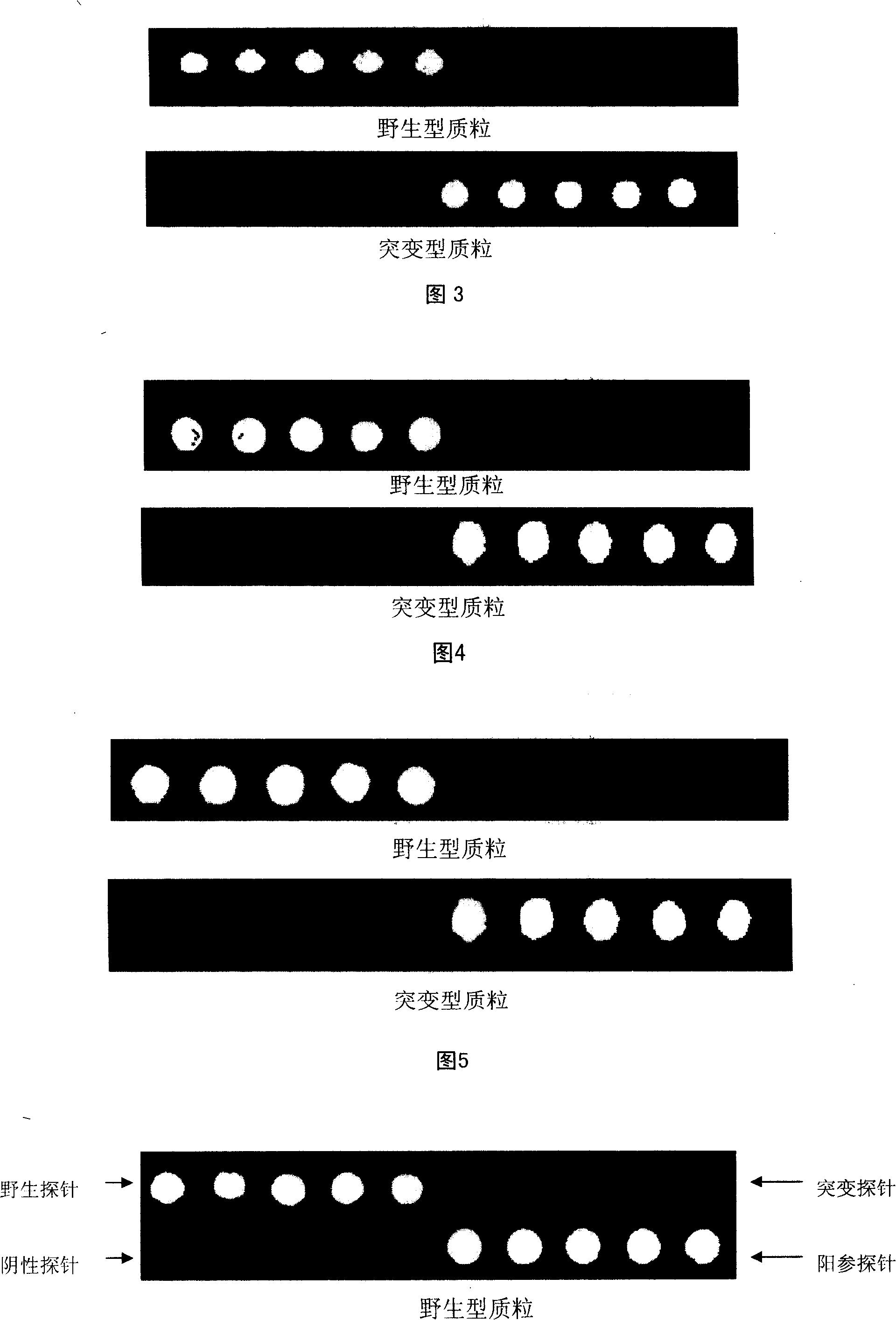 Gene chip for detection of hyperpiesis individual medicine correlated gene mutation and uses thereof