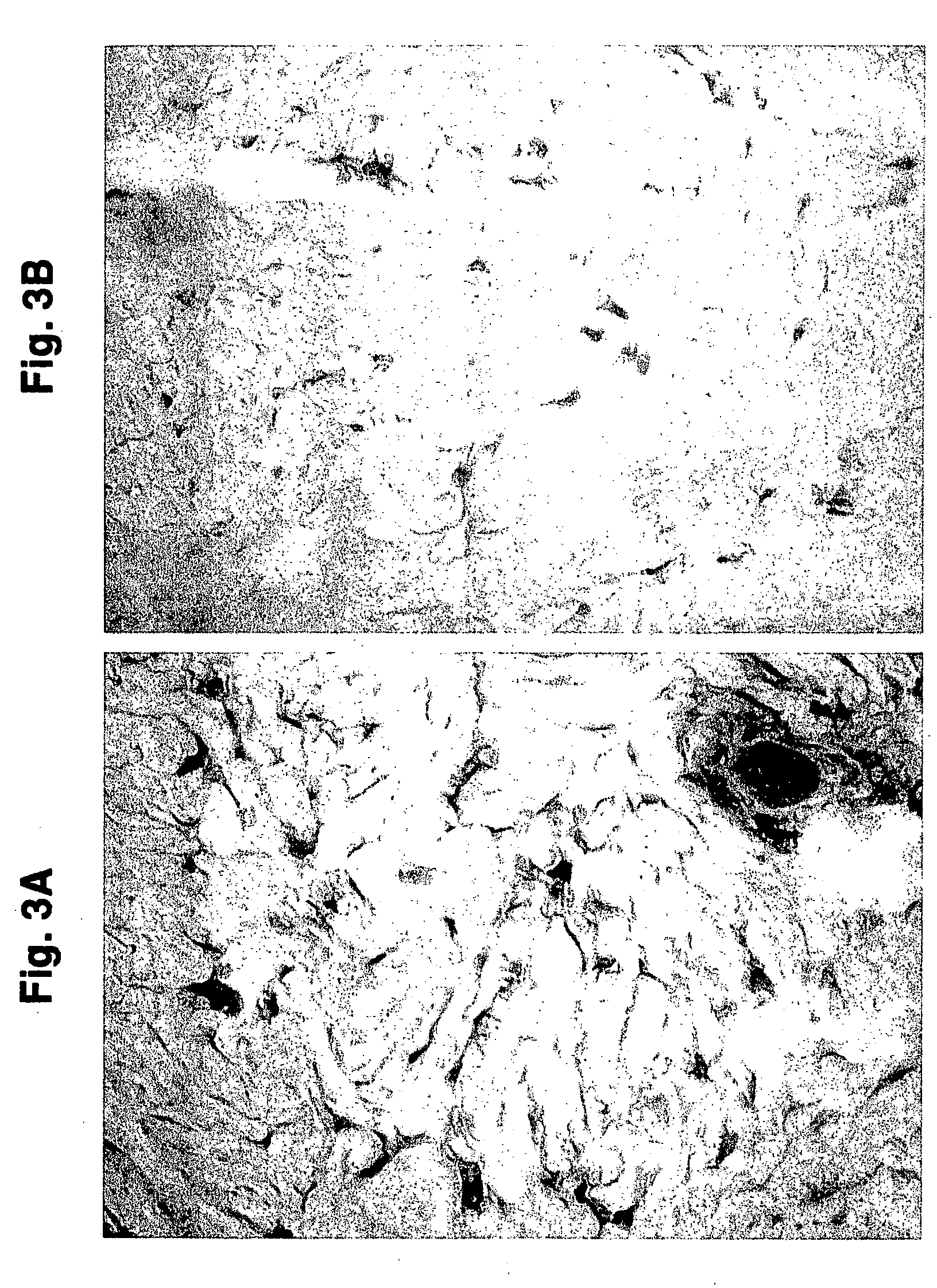 Compositions and methods for use against acne-induced inflammation and dermal matrix-degrading enzymes